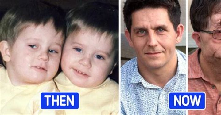 Adam Pearson Children: A Comprehensive Guide to His Family Life