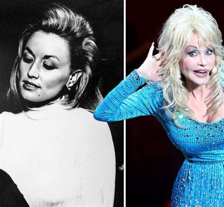 Dolly Parton Without Wig: The Untold Story Behind the Iconic Look