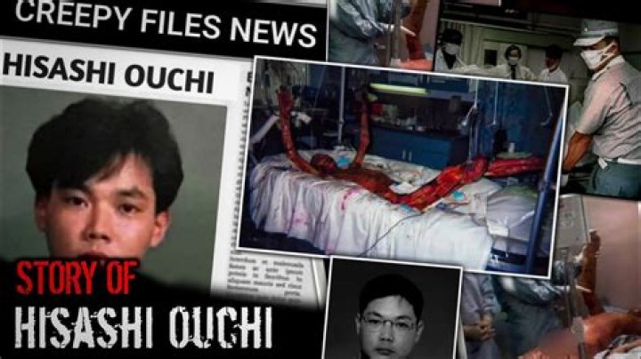 Hisashi Ouchi: The Untold Story and Real Photo Collection