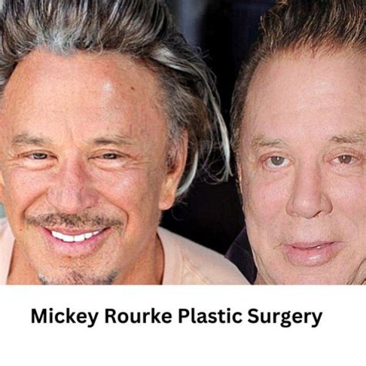 Mickey Rourke: The Remarkable Journey of a Hollywood Icon