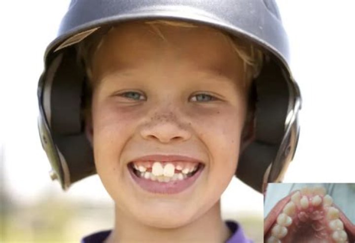 Will Ferrell Teeth: The Iconic Smile Behind the Comedy Legend